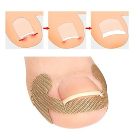 Sticker Ingrown Toenail Tape Care Protection / 스티커 엄지 내성 발톱 테이프 관리 케어 보호