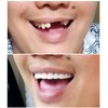 Instant Smile Comfort Fit Flex - Bright Shade - Upper