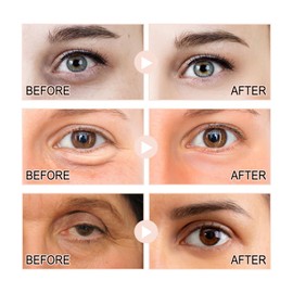 Snail Peptide Eye Cream Stick for Dark Circles and Puffy Eyes,Anti Aging Anti Wrinkle Eye Balm Stick & Eye Bags Remover,Collagen Under Eye Cream Treatment for Men and Women,Hydrating Firming Eye Care