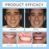 Silicone Reline Denture Set,Silicone Dentures Set, Denture Kit for Dentures,