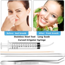 Nuanchu Tonsil Stone Removal Set Includes 2 Stainless Steel Tonsil Stone Removal Tools, 1 Stainless Steel Elbow Tweezers and 100 Long Swabs with 1 Curved Irrigator Syringe to Get Rid of Bad Breath