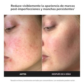 Paula's Choice BOOST Crema Gel Potenciadora de Ácido Azelaico al 10% Suero Facial con Ácido Salicílico, Suero Iluminador de Piel Sin Aceite para Rostro, Sin Fragancia