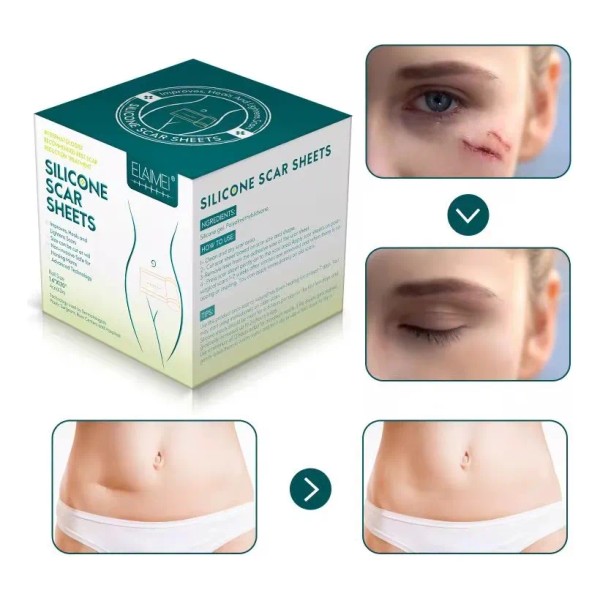 Cinta Silicon Medico Aplana Reduce Cicatriz Reciente Antigua Neutra -