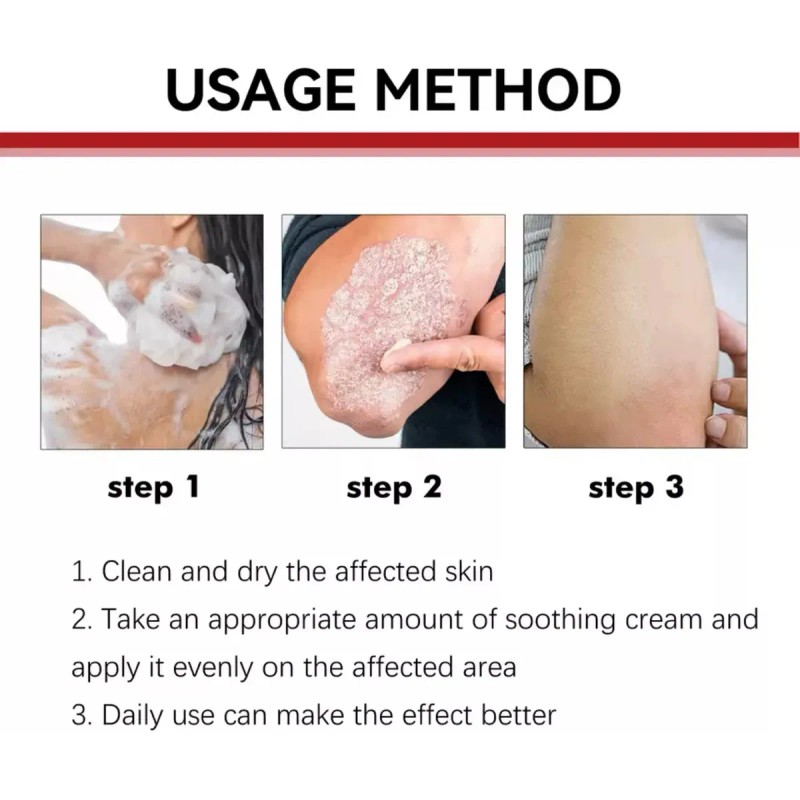 Crema Antibacteriana Psoriasis Eczema Rash Rojo Dermastitis