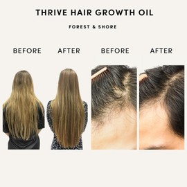 ‎Forest & Shore Hair Growth Oil 100% Natural with Caffeine, Biotin, Castor Oil, Argan Oil, Coconut Oil, and Rosemary Oil for Effective Hair Thickening Hair Mask & Hair Loss Treatment