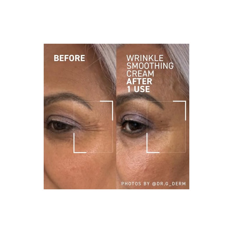 Dr. Brandt Needles No More Wrinkle Smoothing Cream, 0.5 Fl.