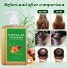 Champú De Aceite De Batana Para El Crecimiento Del Cabello,