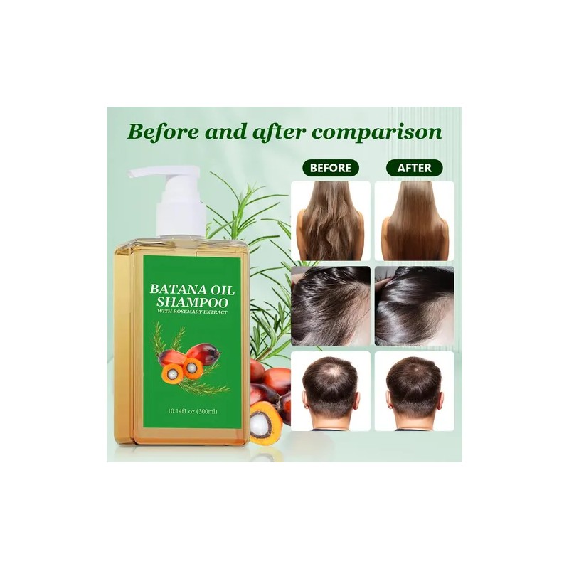 Champú De Aceite De Batana Para El Crecimiento Del Cabello,