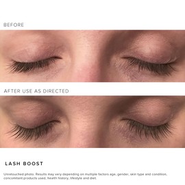 Rodan + Fields R+F Lash Boost Serum | 5 ml | Supports Fuller, Longer-Looking Eyelashes & Brows | Easy Nightly Application | RODAN + FIELDS