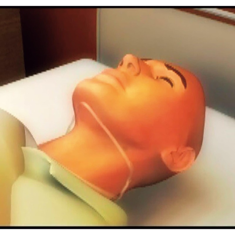 NorMors Chin Color 10 Koiri Matsuyoshi Medical Instrument (M)