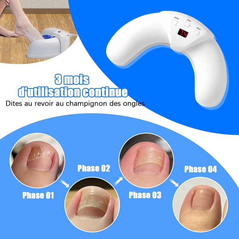 Nail Fungus Laser Against Nail Fungus Device for Multiple Fingernails
