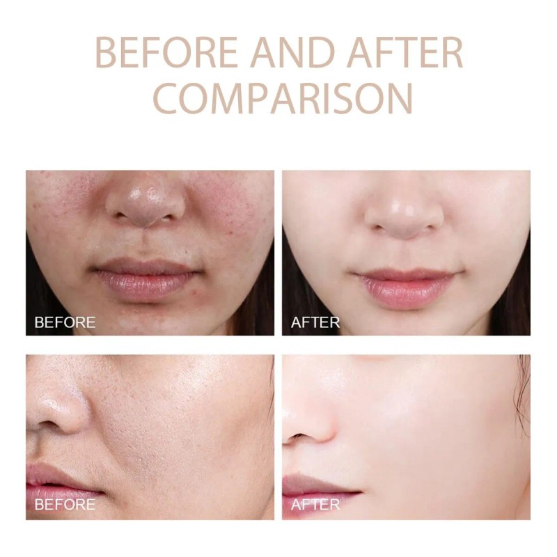 2025 Gel Exfoliante Purificante,exfoliante, Exfoliante Facia