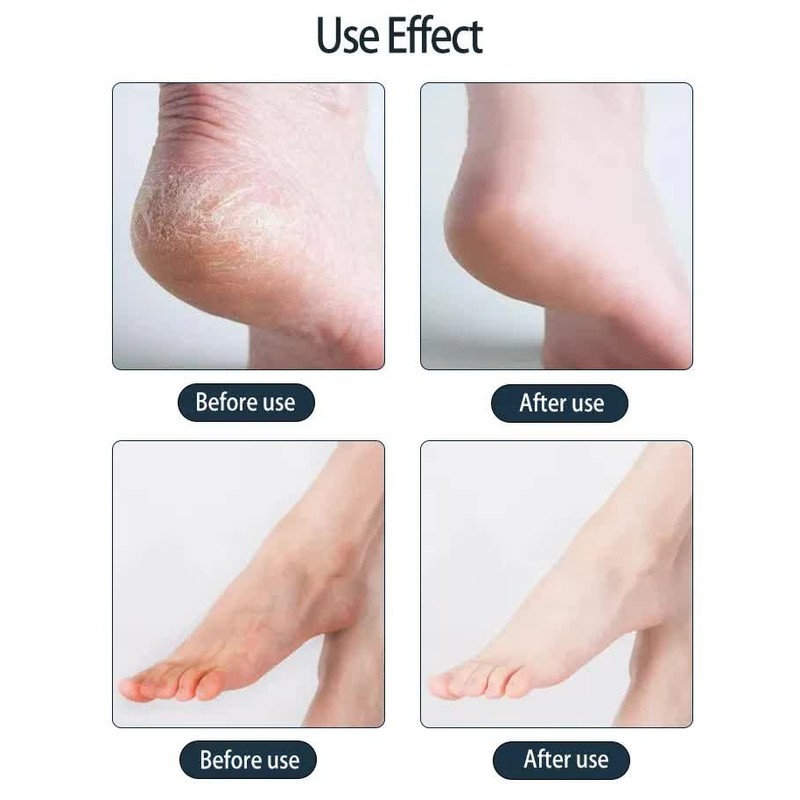 Skailie Moisturizing Foot Mask, white