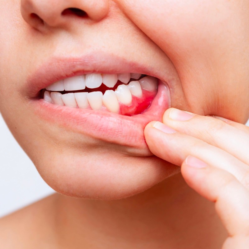 President DENTIFRICIO ACTIVE ad Attività Gengivale. Per gengive irritate, infiammate