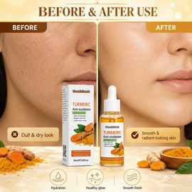 Turmeric Face Serum for Glowing Skin – Brightening Facial Oil for Daily Dark Spot Care