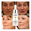 Universo en Linea Kit Lanbena 3pz Serum Vitamina C Ácido