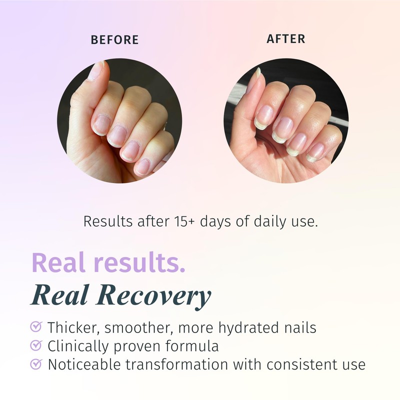 Duri Rejuvacote 2 Nail Growth Base and Top Coat, Balanced