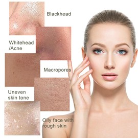 Recovery Mud Mask, Deep Cleansing Mud Mask, Green Mask for Oil Control and Skin Soothing, 110g