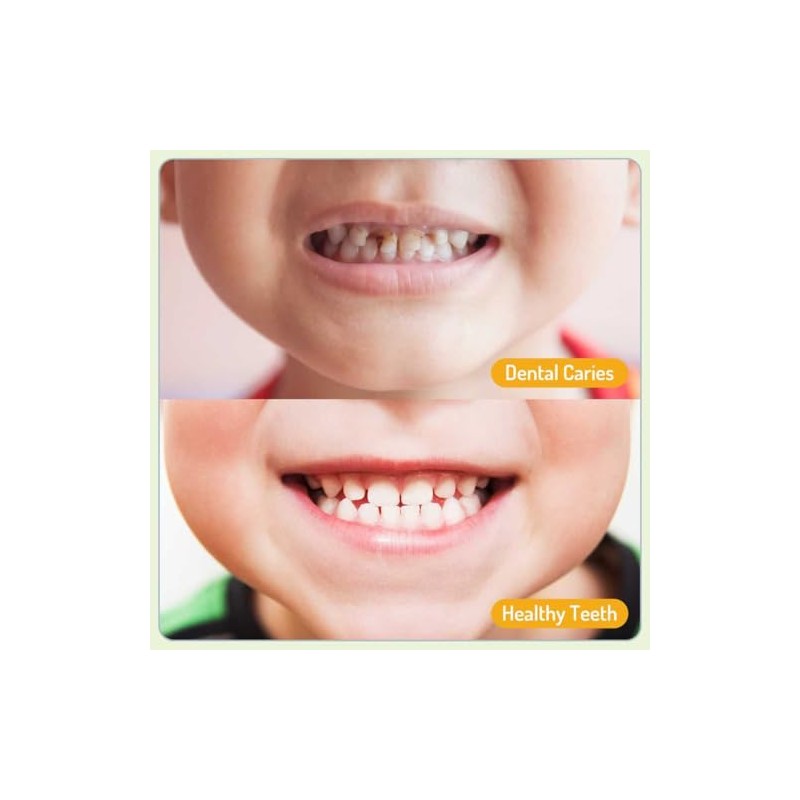 Pego Espray Bucal Niños Limpia Dientes Suavidad Refresca Aliento Instante