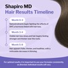 Shapiro MD Hair Growth Experts Shapiro MD Hair Growth Experts