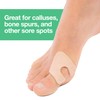 ZenToes U-Shaped Felt Callus Pads | Protect Calluses from Rubbing