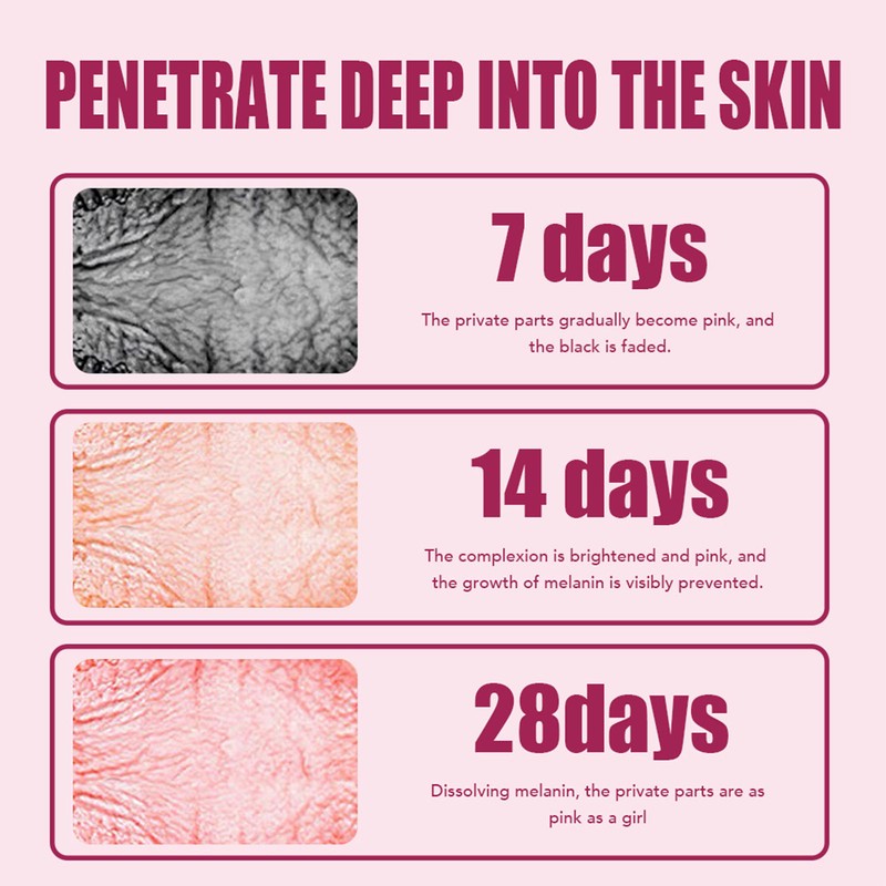 5pcs Women Private Part Mask Dilute Melanin Deep Moisturizing Skin