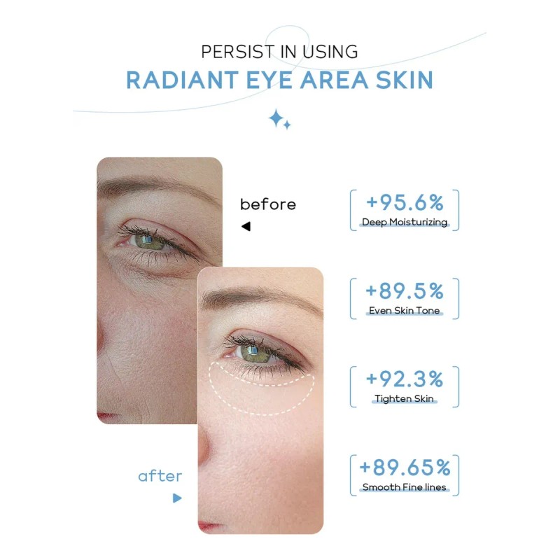 My Crema De Ojos Radiante Roll-on De Leche 20g Hidratante