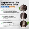 Dermasolve Psoriasis & Dandruff Oil, Dermatologist Approved for Flaky Scalp