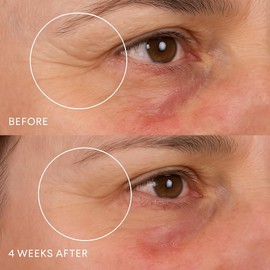 BYRANA Bakuchiol Ceramide Peptide Cream Face Moisturizer with Bakuchiol, Ceramides, 9 Peptides & Fermented Black Ginseng for Fine Lines, Dry & Sensitive Skin, 1.7 oz