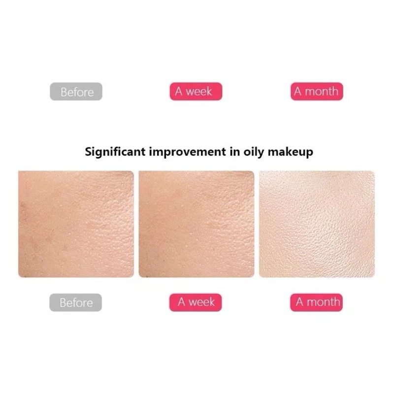 Muye Skin Scrubber Ultrasónico - Galvánica & Pelling + Colageno