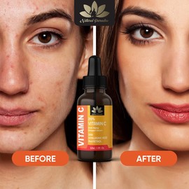 Natural Paradise 20% Vitamin C Face Serum - Aloe Vera Facial Serum With Hyaluronic Acid, Aloe Vera, & Green Tea, Facial Serum for Dark Spots, Vitamin C Serum For Face, Skin Clearing - Made In Canada - 60 mL