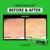 Diebu Tricasso Kit (Ampoule + Gel + Cream) / 디에뷰