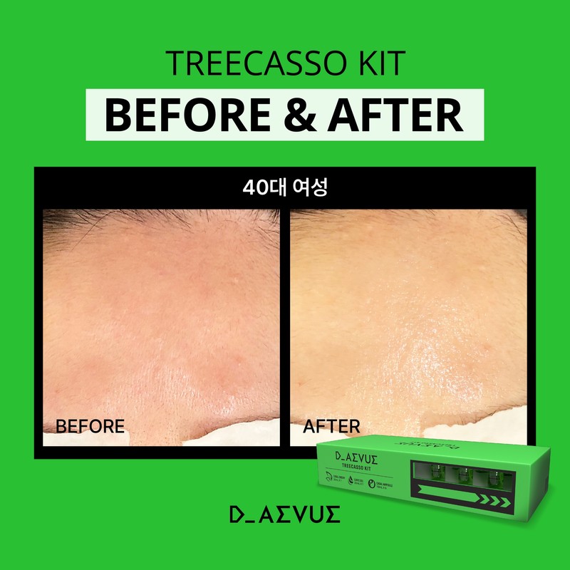 Diebu Tricasso Kit (Ampoule + Gel + Cream) / 디에뷰