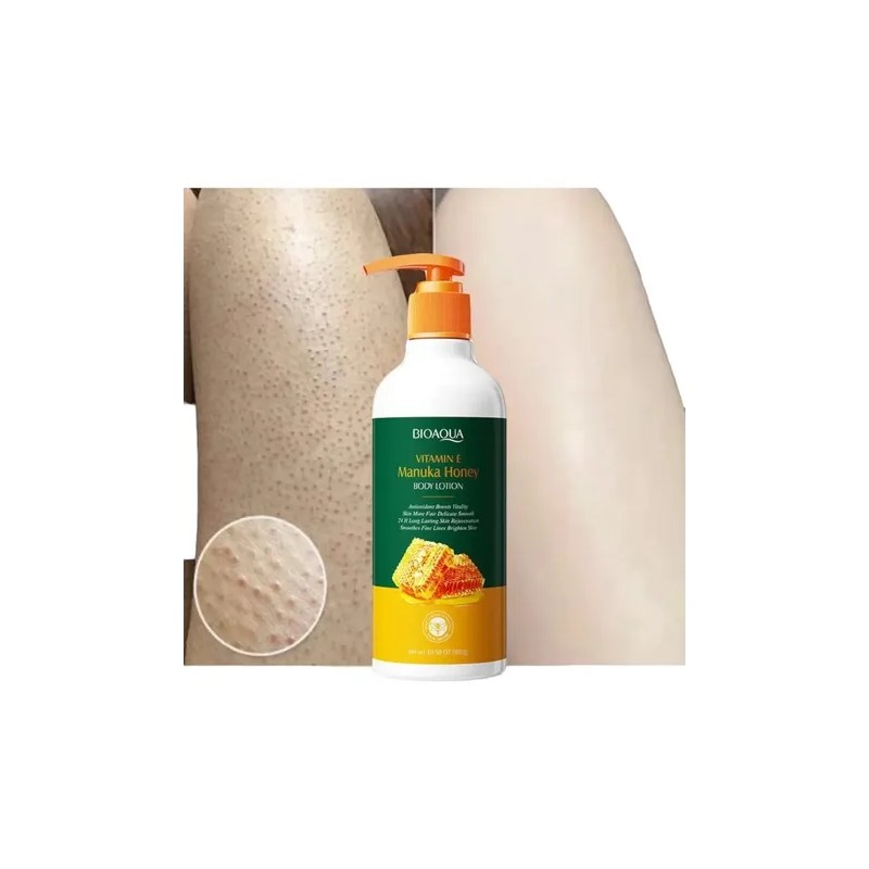 Crema Locion Extracto De Miel Quita Piel De Gallina Regenera