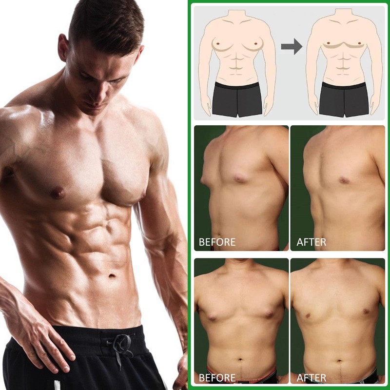 Ginger Gynecomastia Cream for Men, Ginger Skin Tightening Cream for