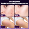 Gel Facial Anti Piel Acne Contiene Adapalene