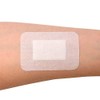 Teqler Sterile Wound Dressing 10 x 8 cm