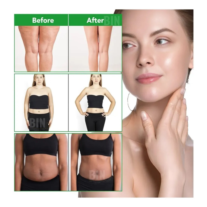 Aceite Masaje Corporal Aliver Anticelulitis Moldeador 250ml
