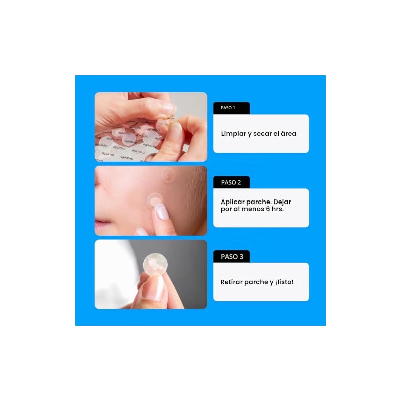 Avarelle Acne Cover Spot Patch Hydrocolloid, Tea Tree & Calendula