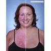 Dermacia PRO Breathable Foundation (Beige), Dr. Recommended, Hypoallergenic, Long Lasting,