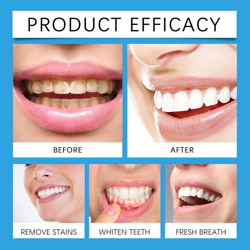 2PCS Teeth Whitening Paints,Tooth Polishing Paste,Whitening Toothpaste,Instant & Long-Lasting Results,Dual