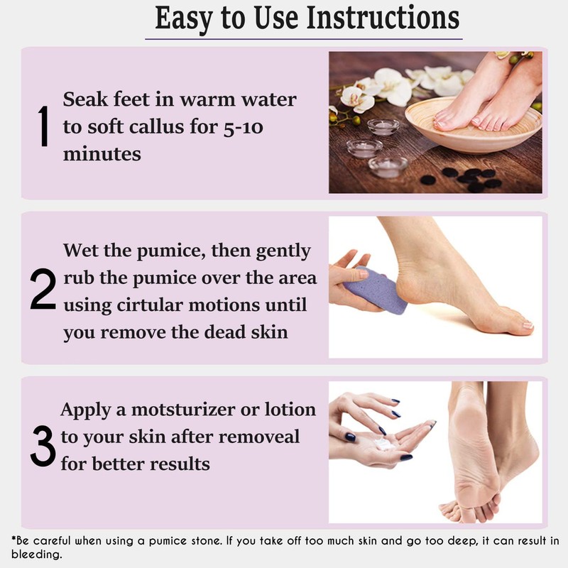6 Packs Foot Pumice Stone, Double Sided Foot Scrub for