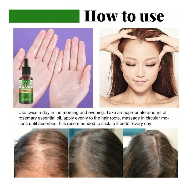Pelo Aceite De Romero Para El Crecimiento Del Cabello, Suero