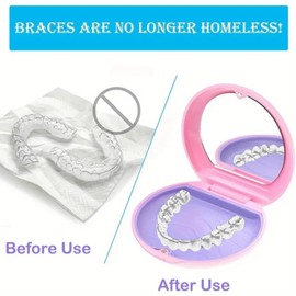 Retainer Case,Retainer Box,Magnetic Closure Portable Orthodontic Denture Case,Multifunctional Mouth Guard Case,Anti-Slip Design Aligner Case,Night Guard Retainer Case,Container Storage Holder,White