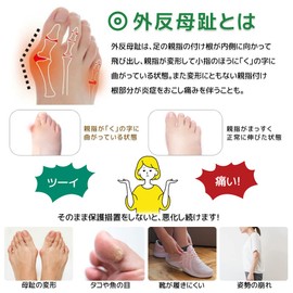 外反母趾 サポーター 内反小趾 同時対策 【最新アップグレード&2足入り】 女性用 足指広げる 母趾小趾サポーター 外反母趾対策 足指サポーター 外反母趾グッズ 足指セパレーター ジェル製 抗菌 防臭(Lサイズ,（23.5-25.5㎝）)