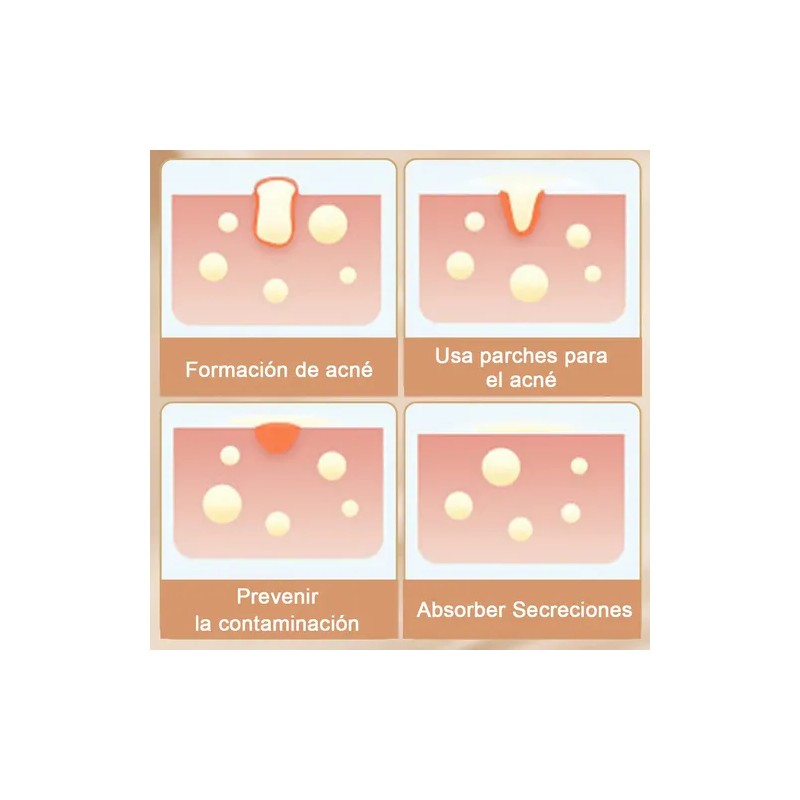 240pzs Mascarillas Estrella Para El Acne Espinillas Granos