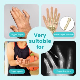 Fingers Splint, Adjustable Finger & Metacarpal Brace, 2 Aluminum Plate Support, Trigger Finger Splint, Finger Correction Immobilizer, Finger Fracture, Arthritis,Mallet Finger, Sprain (1-Finger)