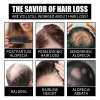 Biotin B7 Hydrolyzed Collagen Hair Care Essential Oil Nourish Scalp
