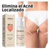 Crema Para Acné En Glúteos 100ml Elimina Granos Y Espinillas