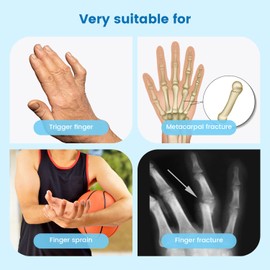 Finger Splint, Trigger Finger Splint, Boxer Break Metacarpal Brace, 2 Aluminum Plate Support, Adjustable Finger Extension Immobilization, for Finger Fracture,Sprain,Arthritis,Mallet Finger (1-finger)